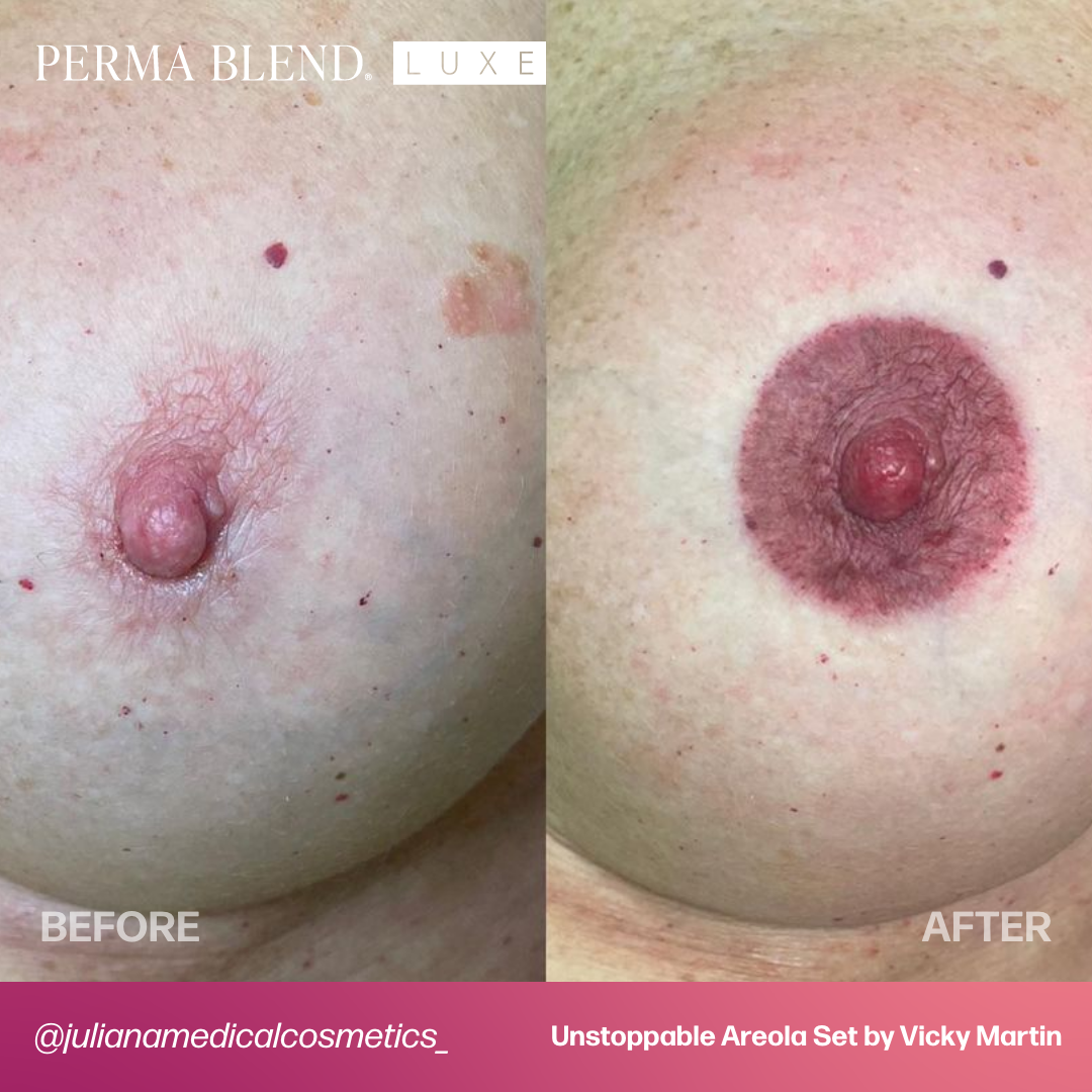 LUXE Unstoppable Areola Set by Vicky Martin Areola - Perma Blend