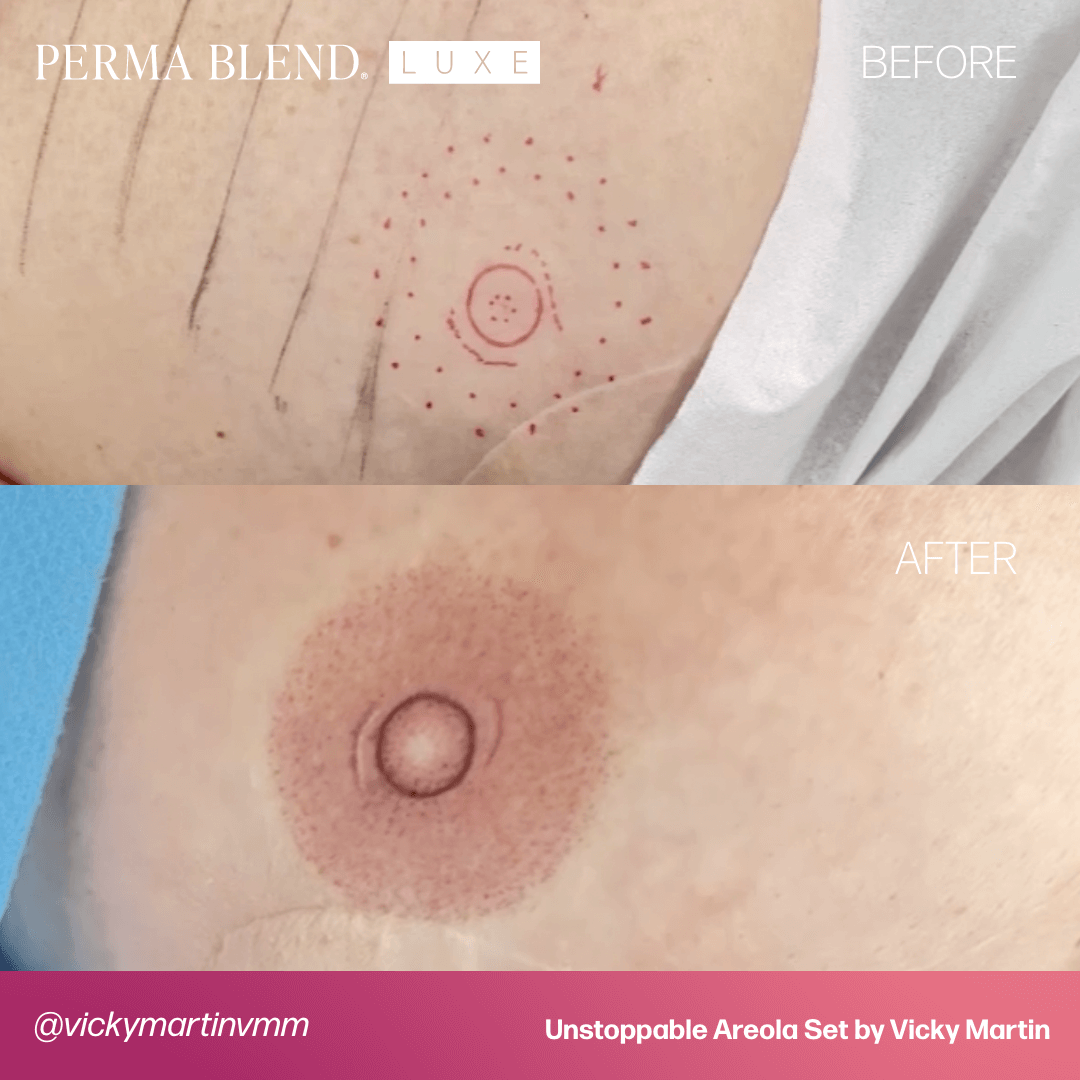 Vicky Martin Unstoppable Areola Set Restoration PMU