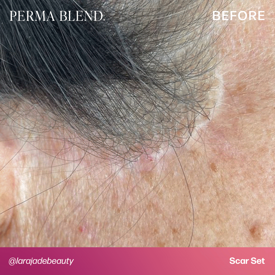 Mandy Sauler Scar Set