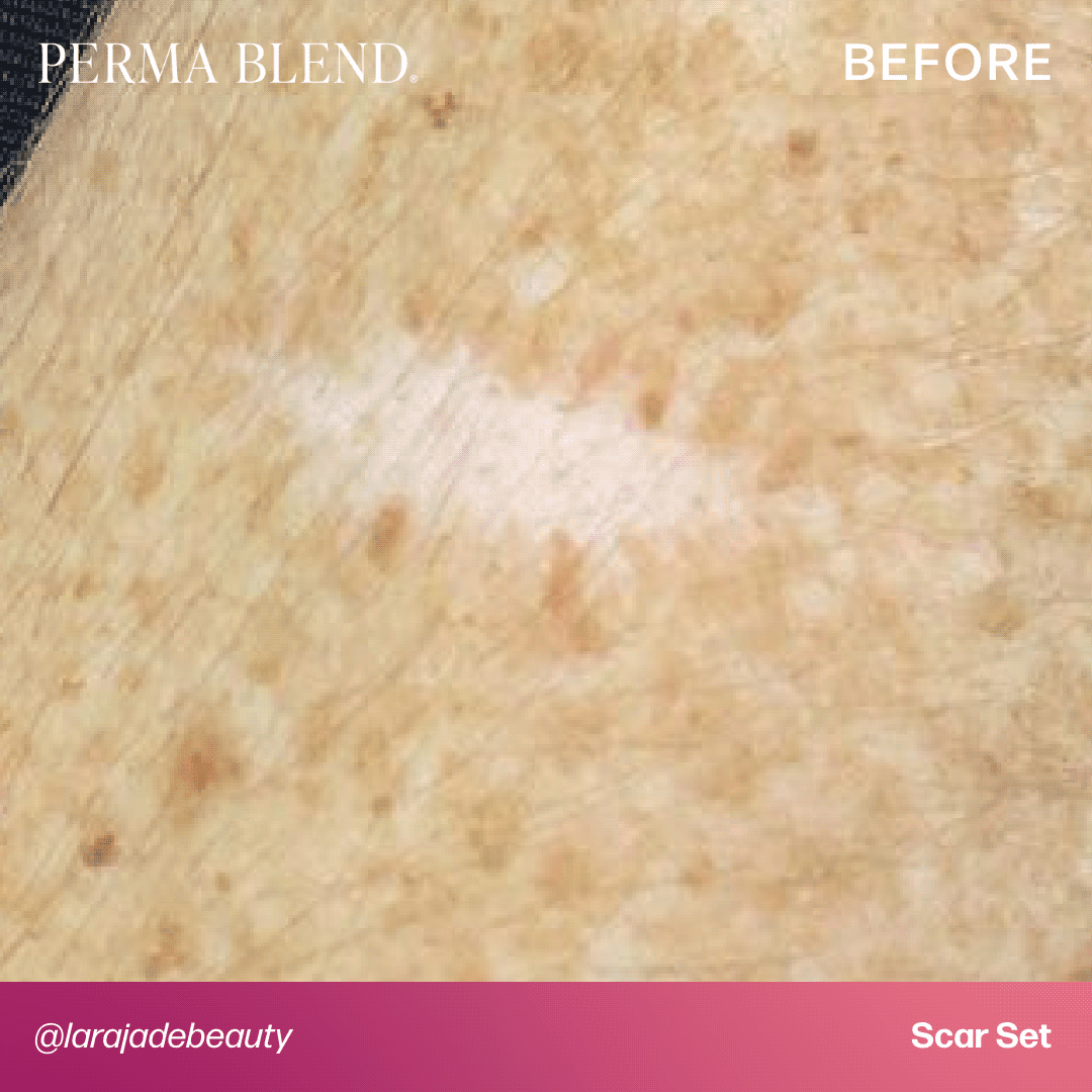 Mandy Sauler Scar Set