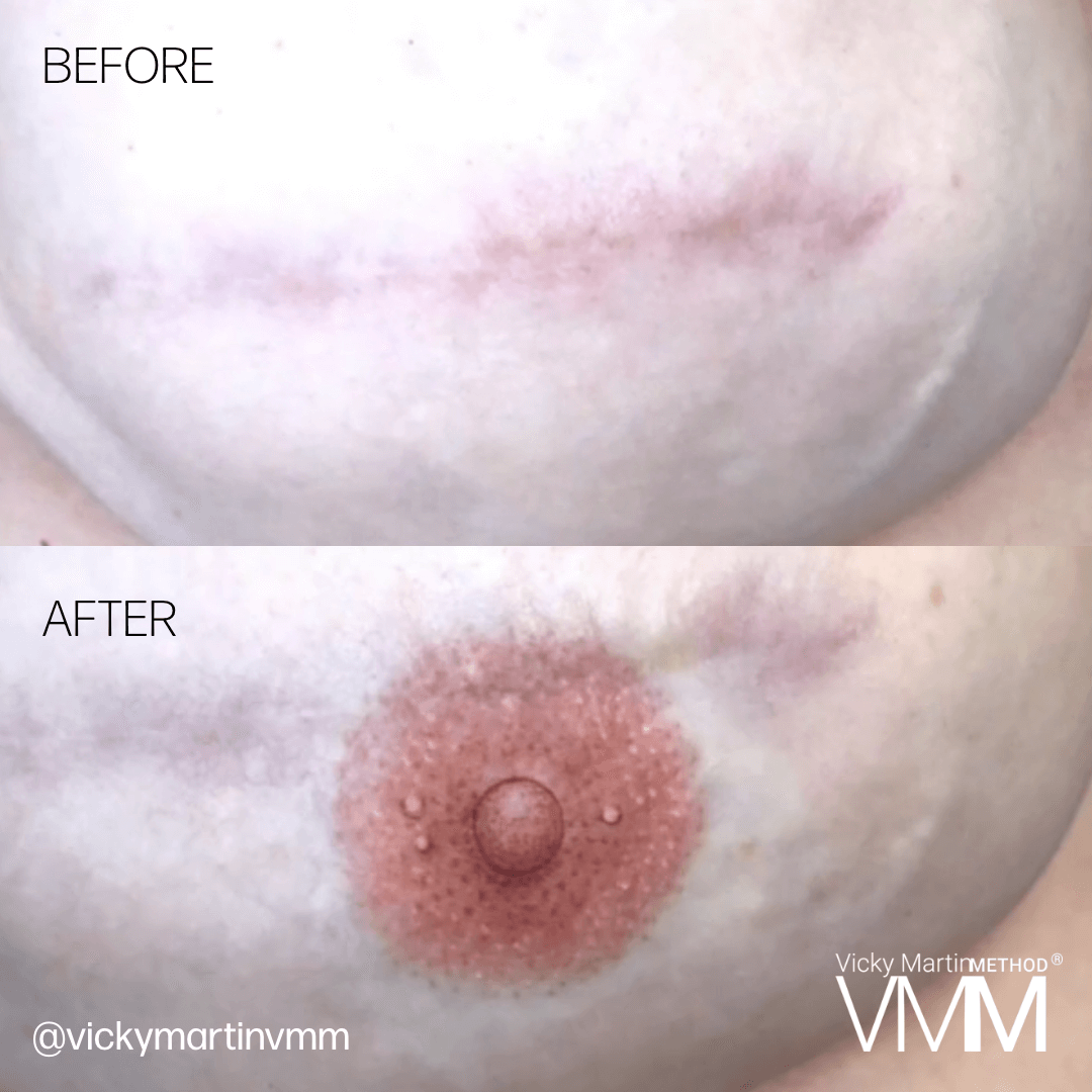 Areola Permanent Makeup reconstruction by Vicky Martin, Perma Blend Pro Team Artist