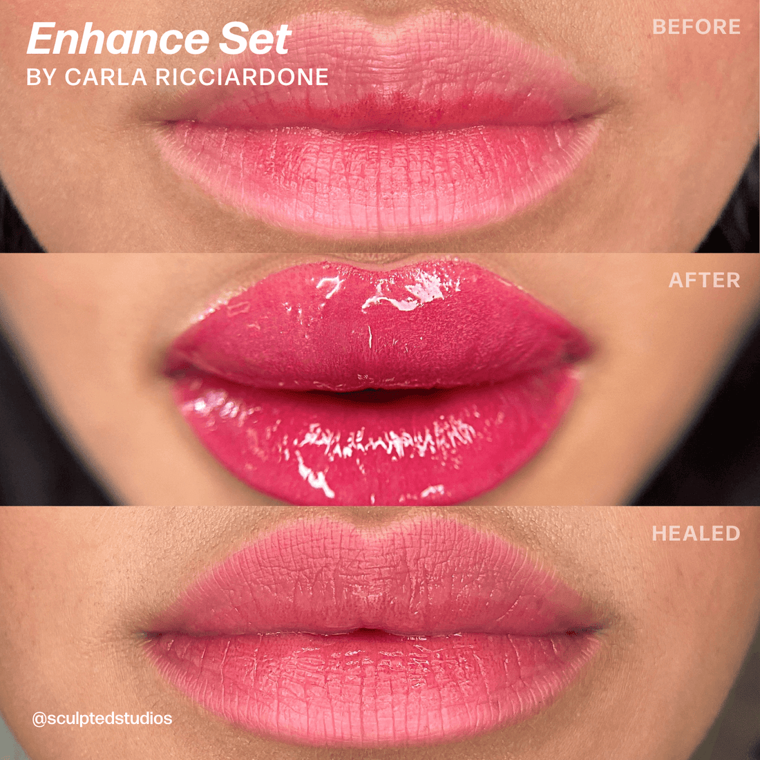 LUXE Enhance Set by Sculpted – Carla Ricciardone